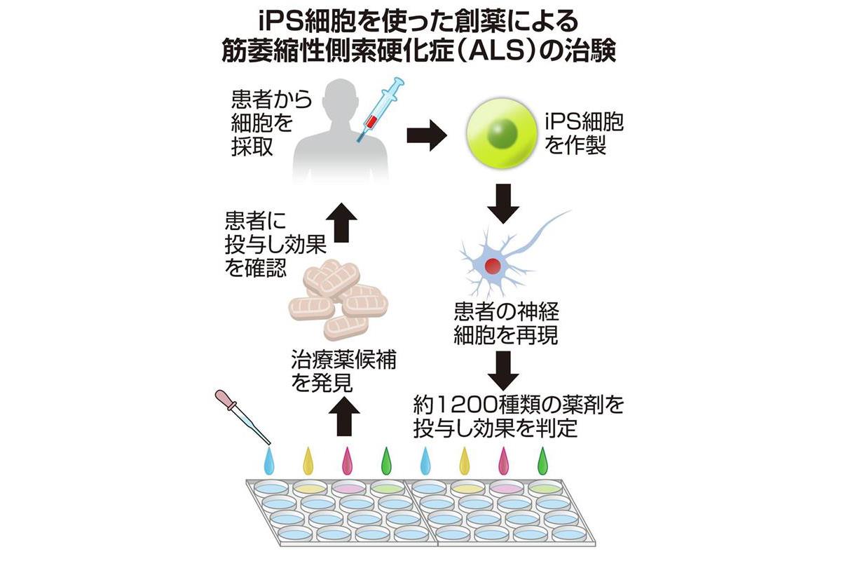 世界初 Ips創薬で発見のals治療薬候補 慶応大の研究チームが有効性を確認 Sankeibiz サンケイビズ 自分を磨く経済情報サイト